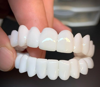 Olvoria | Facettes dentaires DentAlign – Ajustement naturel et confort