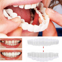 Olvoria | Facettes dentaires On Smile (mâchoire supérieure et inférieure incluses)