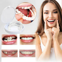 Facettes Snap on Smile (supérieures et inférieures)